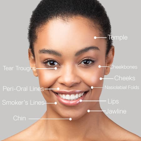 Dermal Fillers